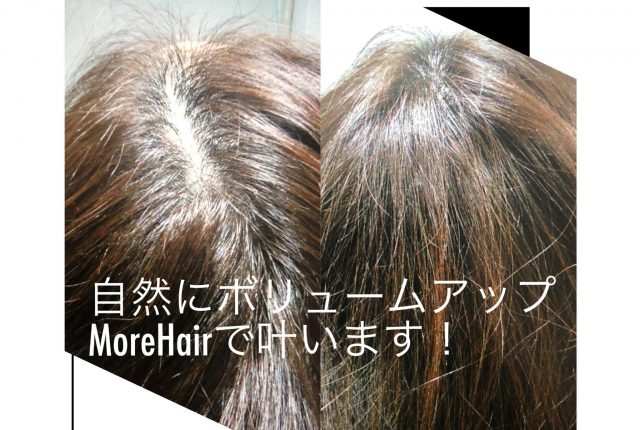 More Hair｜増毛エクステ（ループエクステ）専門店 モアヘア